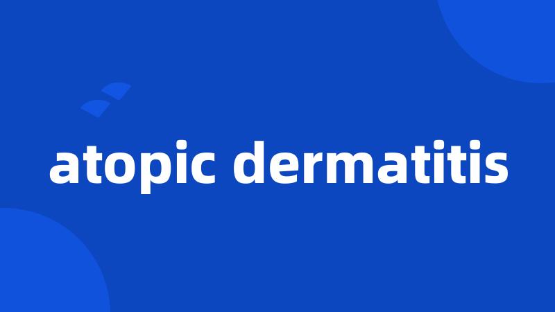 atopic dermatitis