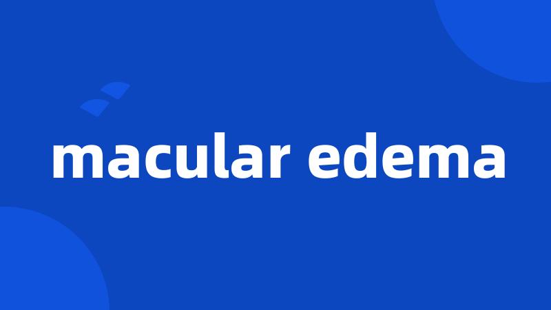 macular edema