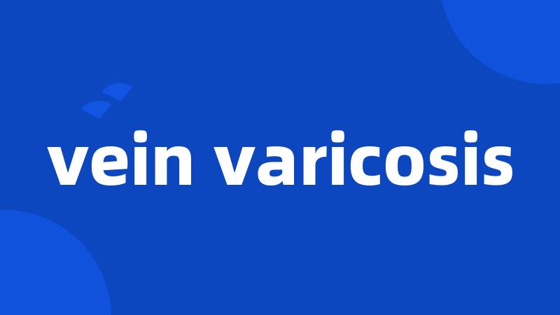 vein varicosis